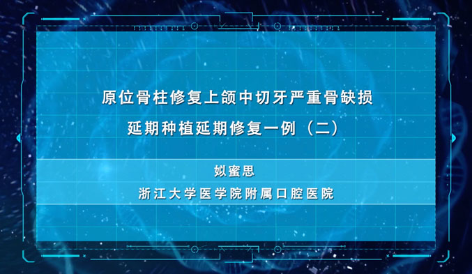 原位骨柱修复上颌中切牙严重骨缺损延期种植延期修复一例（二）