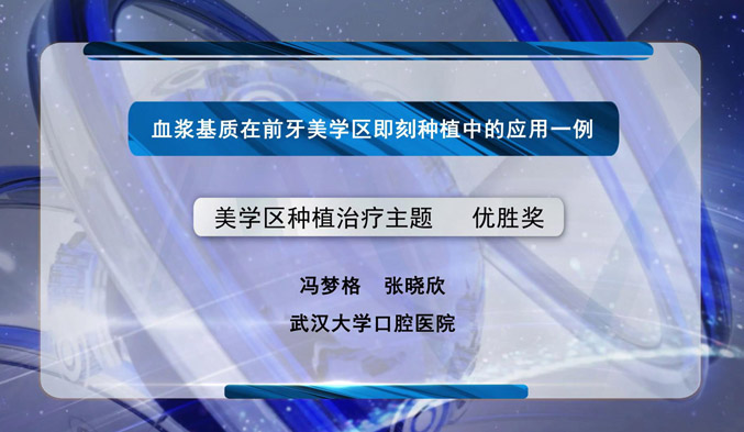 血浆基质在前牙美学区即刻种植中的应用一例
