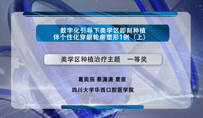 数字化引导下美学区即刻种植伴个性化穿龈轮廓塑形一例（上）