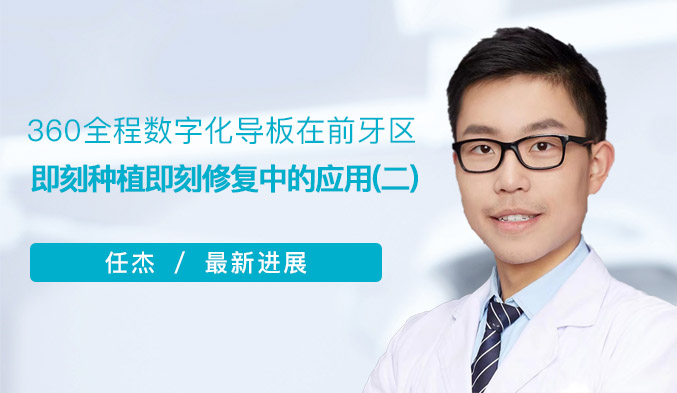 360全程数字化导板在前牙区即刻种植即刻修复中的应用（二）