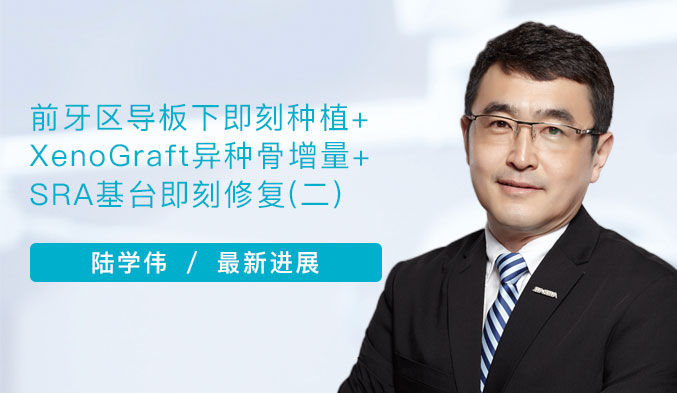 前牙区导板下即刻种植+XenoGraft异种骨增量+SRA基台即刻修复（二）