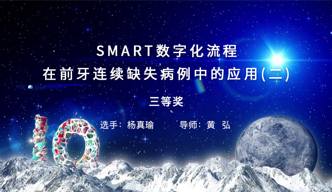 SMART数字化流程在前牙连续缺失病例中的应用（二）