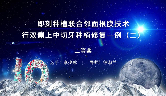 即刻种植联合邻面根膜技术行双侧上中切牙种植修复一例（二）