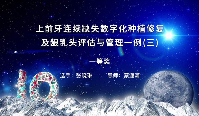 上前牙连续缺失数字化种植修复及龈乳头评估与管理一例（三）