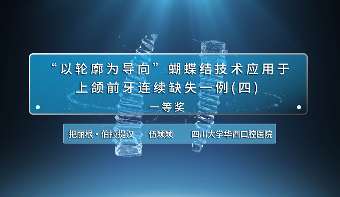 “以轮廓为导向”蝴蝶结技术应用于上颌前牙连续缺失一例（四）