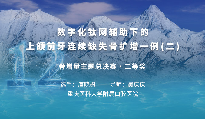数字化钛网辅助下的上颌前牙连续缺失骨扩增一例（二）
