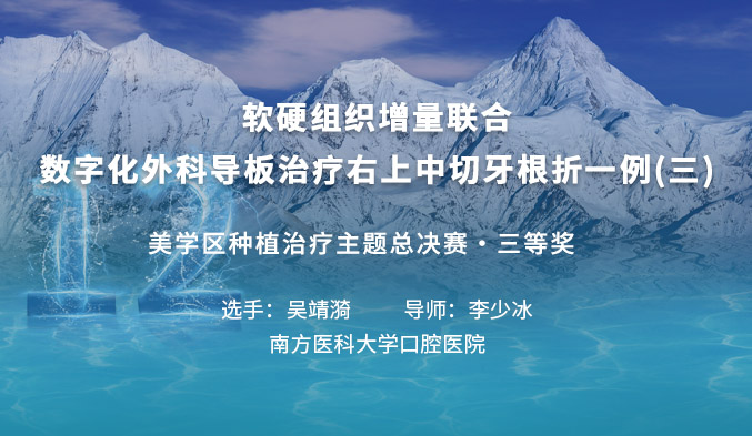 软硬组织增量联合数字化外科导板治疗右上中切牙根折一例（三）
