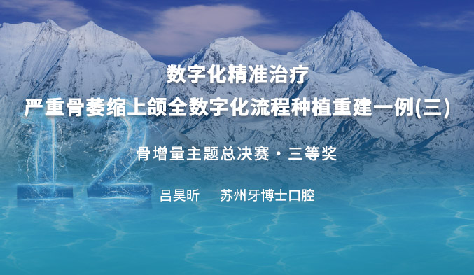 数字化精准治疗--严重骨萎缩上颌全数字化流程种植重建一例（三）