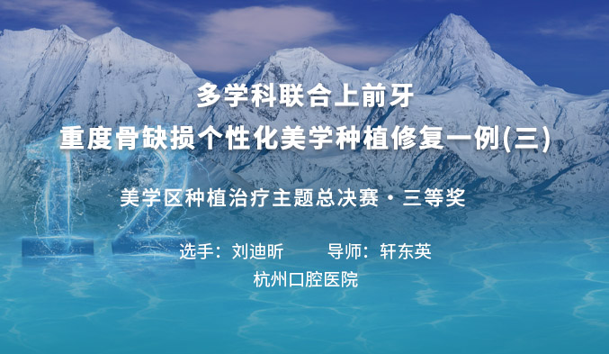 多学科联合上前牙重度骨缺损个性化美学种植修复一例（三）