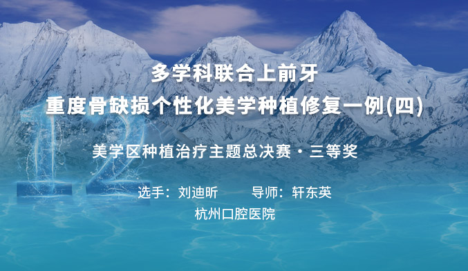 多学科联合上前牙重度骨缺损个性化美学种植修复一例（四）
