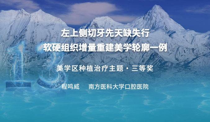 左上侧切牙先天缺失行软硬组织增量重建美学轮廓一例