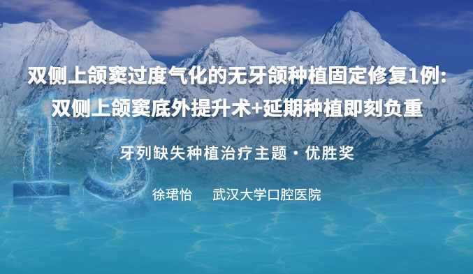 双侧上颌窦过度气化的无牙颌种植固定修复1例:双侧上颌窦底外提升术+延期种植即刻负重