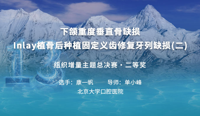 下颌重度垂直骨缺损Inlay植骨后种植固定义齿修复牙列缺损（二）