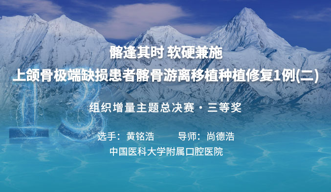 髂逢其时 软硬兼施——上颌骨极端缺损患者髂骨游离移植种植修复1例(二) 髂逢其时 软硬兼施——上颌骨极端缺损患者髂骨游离移植种植修复1例(二)