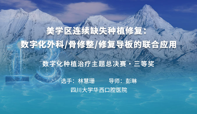 美学区连续缺失种植修复：数字化外科/骨修整/修复导板的联合应用