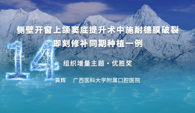侧壁开窗上颌窦底提升术中施耐德膜破裂即刻修补同期种植一例