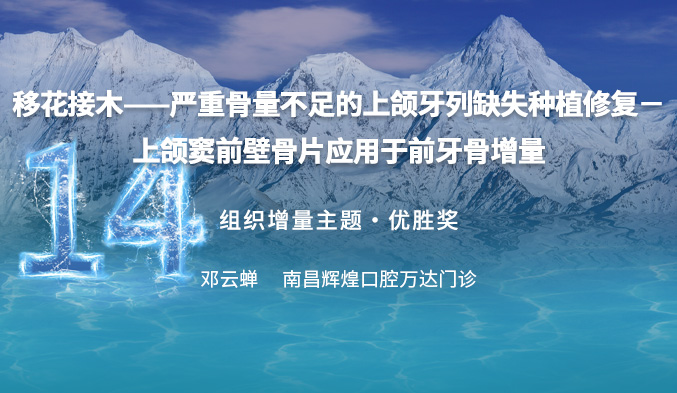 移花接木——严重骨量不足的上颌牙列缺失种植修复－上颌窦前壁骨片应用于前牙骨增量