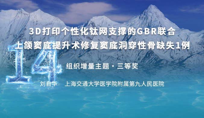 3D打印个性化钛网支撑的GBR联合上颌窦底提升术修复窦底洞穿性骨缺失1例