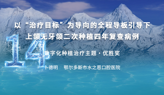 以“治疗目标”为导向的全程导板引导下上颌无牙颌二次种植四年复查病例