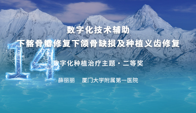 数字化技术辅助下髂骨瓣修复下颌骨缺损及种植义齿修复