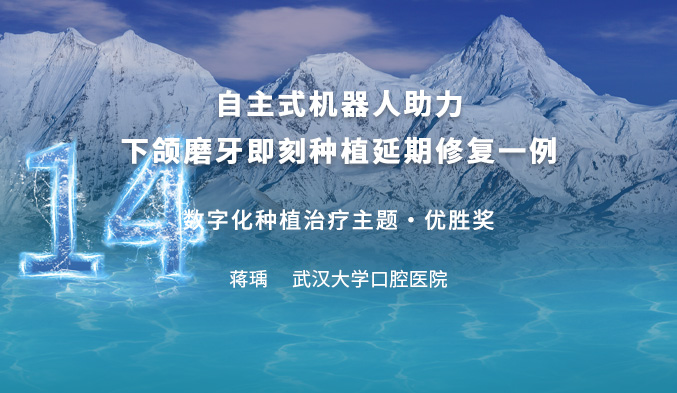 自主式机器人助力下颌磨牙即刻种植延期修复一例