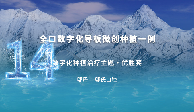 全口数字化种植病例--导板微创种植