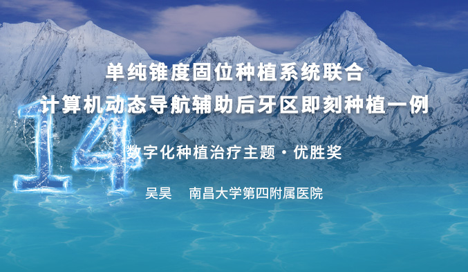 数字化动态导航辅助单纯锥度固位种植系统应用于后牙区即刻种植