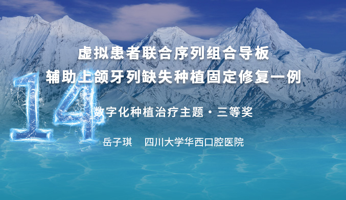 虚拟患者联合序列组合导板辅助上颌牙列缺失种植固定修复一例