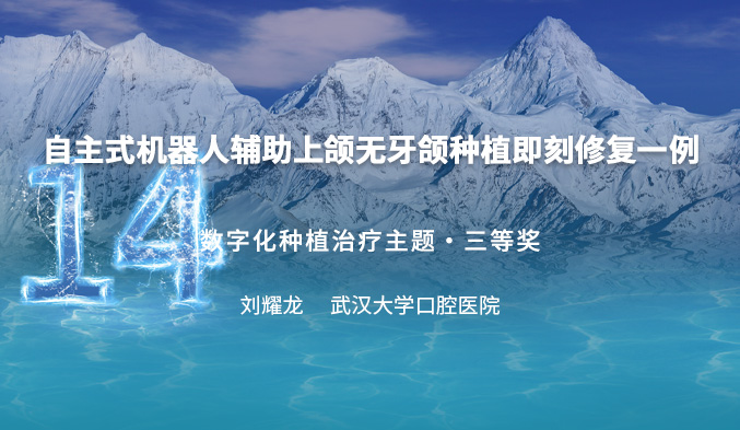 自主式机器人辅助上颌无牙颌种植即刻修复一例