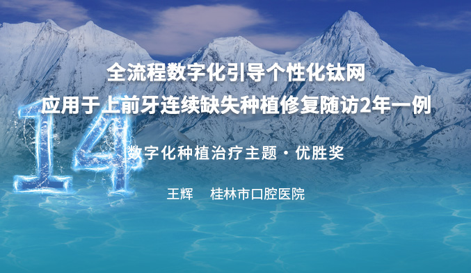 全流程数字化引导个性化钛网应用于上前牙连续缺失种植修复随访2年一例