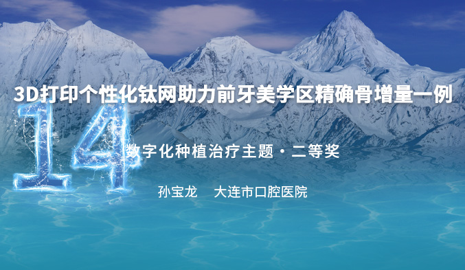 3D打印个性化钛网助力前牙美学区精确骨增量一例