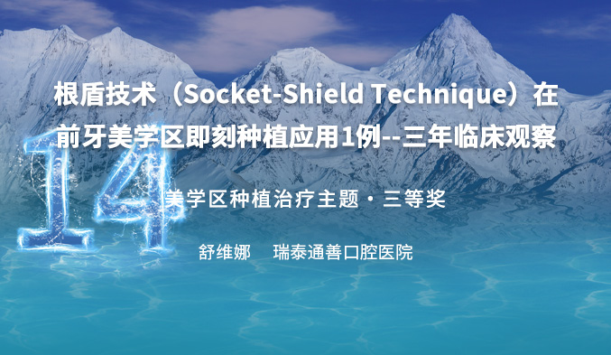 根盾技术（Socket-Shield Technique）在前牙美学区即刻种植应用1例--三年临床观察