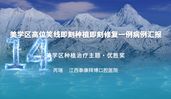 美学区高位笑线即刻种植即刻修复一例病例汇报