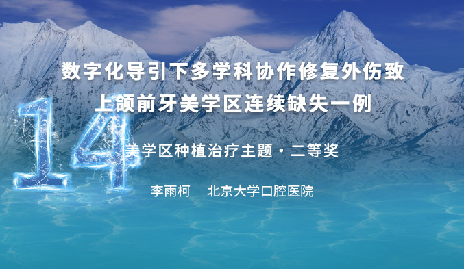 外伤致上颌前牙美学区连续缺失修复一例