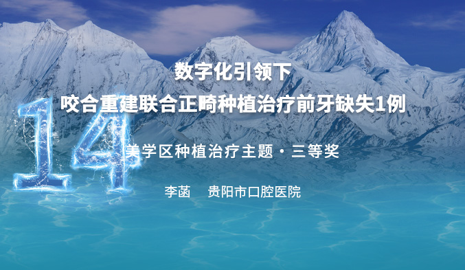 数字化引领下咬合重建联合正畸种植治疗前牙缺失一例