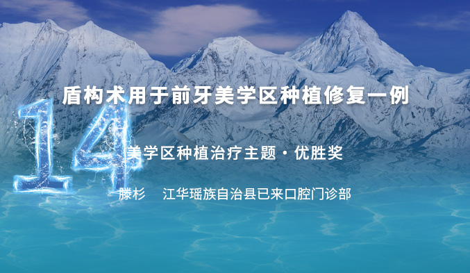 盾构术用于前牙美学区种植修复一例