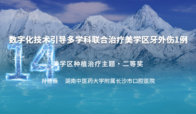 数字化技术引导多学科联合治疗美学区牙外伤一例