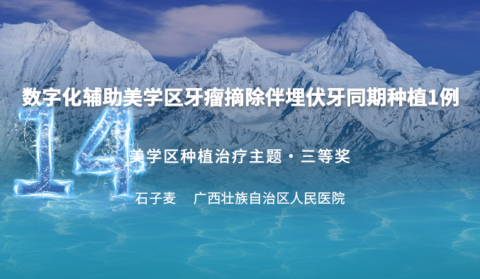 数字化辅助美学区牙瘤摘除伴埋伏牙同期种植一例