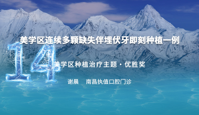 美学区连续多颗缺失伴埋伏牙即刻种植一例