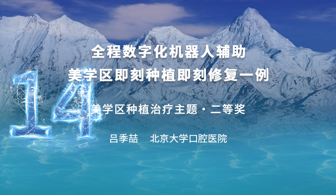 全程数字化机器人辅助美学区即刻种植即刻修复一例