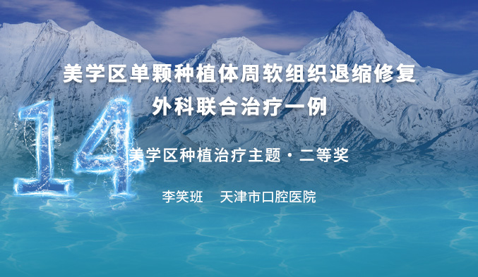 美学区单颗种植体周软组织退缩修复-外科联合治疗一例