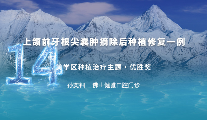 上颌前牙根尖囊肿摘除后种植修复一例