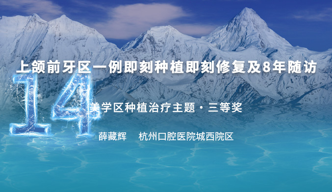 上颌前牙区一例即刻种植即刻修复及8年随访