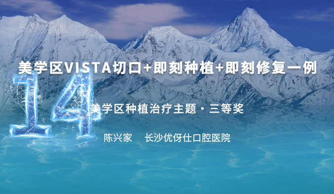 美学区VISTA切口+即刻种植+即刻修复一例