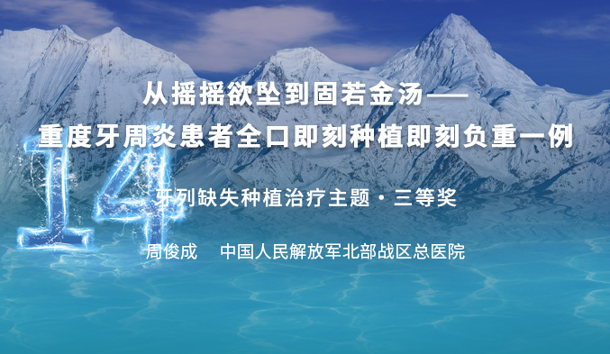 从摇摇欲坠到固若金汤——重度牙周炎患者全口即刻种植即刻负重一例