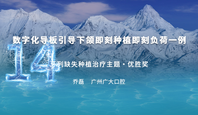 数字化导板引导下颌即刻种植即刻负荷一例