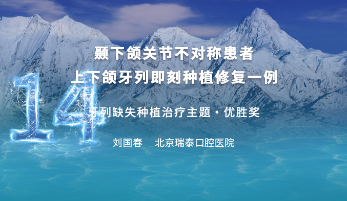 颞下颌关节不对称患者上下颌牙列即刻种植修复一例