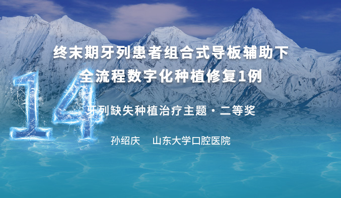 终末期牙列患者组合式导板辅助下全流程数字化种植修复1例