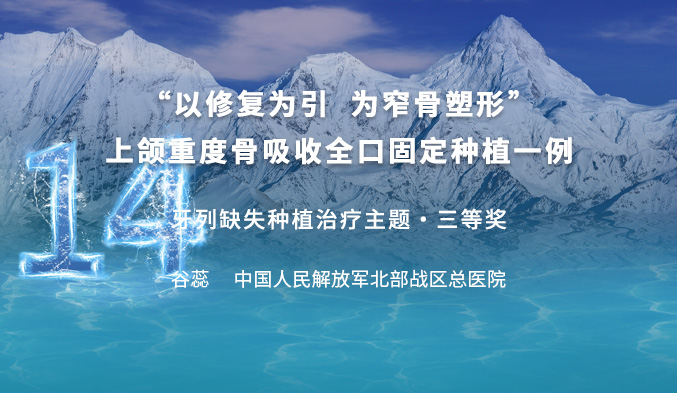 “以修复为引  为窄骨塑形”上颌重度骨吸收全口固定种植一例