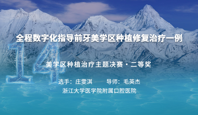 全程数字化指导前牙美学区种植修复治疗一例